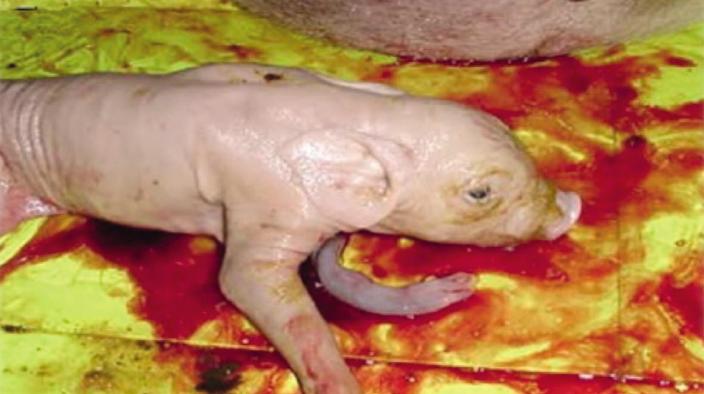 EXCESSIVE INTRA-UTERINE PRESSURE DURING BIRTH